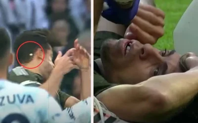 Beşiktaş’ta art arda şanssızlıklar! 2 sakatlık ve bir diş kırığı